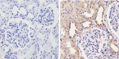 Immunohistochemistry-Paraffin: Cytochrome P450 3A7 Antibody (F19 P2 H2) [NB100-74402] - Analysis showing positive staining in the cytoplasm of Human kidney tissue (right) compared with a negative control in the absence of primary antibody (left).
