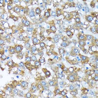 Immunohistochemistry-Paraffin: Cytochrome P450 4A Antibody (10D10W7) [NBP3-15847] - Immunohistochemistry of paraffin-embedded rat liver using Cytochrome P450 4A (CYP4A11) Rabbit mAb (NBP3-15847) at dilution of 1:100 (40x lens).Perform microwave antigen retrieval with 10 mM Tris/EDTA buffer pH 9.0 before commencing with IHC staining protocol.