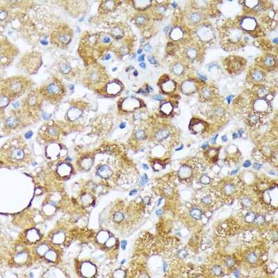 Immunohistochemistry-Paraffin: Cytochrome P450 4A Antibody (10D10W7) [NBP3-15847] - Immunohistochemistry of paraffin-embedded human liver using Cytochrome P450 4A (CYP4A11) Rabbit mAb (NBP3-15847) at dilution of 1:100 (40x lens).Perform microwave antigen retrieval with 10 mM Tris/EDTA buffer pH 9.0 before commencing with IHC staining protocol.