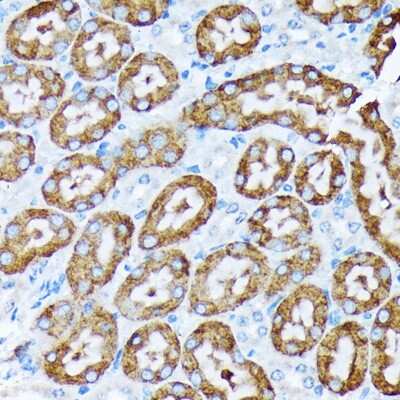 Immunohistochemistry-Paraffin: Cytochrome P450 4A Antibody (10D10W7) [NBP3-15847] - Immunohistochemistry of paraffin-embedded mouse kidney using Cytochrome P450 4A (CYP4A11) Rabbit mAb (NBP3-15847) at dilution of 1:100 (40x lens).Perform microwave antigen retrieval with 10 mM Tris/EDTA buffer pH 9.0 before commencing with IHC staining protocol.