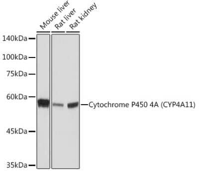 Western Blot: Cytochrome P450 4A Antibody (10D10W7) [NBP3-15847] - Western blot analysis of extracts of various cell lines, using Cytochrome P450 4A (CYP4A11) Rabbit mAb (NBP3-15847) at 1:1000 dilution. Secondary antibody: HRP Goat Anti-Rabbit IgG (H+L) at 1:10000 dilution. Lysates/proteins: 25ug per lane. Blocking buffer: 3% nonfat dry milk in TBST. Detection: ECL Basic Kit. Exposure time: 10s.