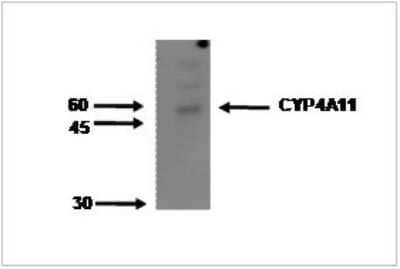 Western Blot: Cytochrome P450 4A Antibody (M25-P2A10) [NBP2-50212]