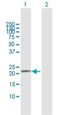 Western Blot: Cytochrome P450 4A Antibody [H00001579-B01P] - Analysis of CYP4A11 expression in transfected 293T cell line by CYP4A11 polyclonal antibody.  Lane 1: CYP4A11 transfected lysate(23.76 KDa). Lane 2: Non-transfected lysate.