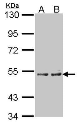 Western Blot: Cytochrome P450 4A Antibody [NBP1-31427] - Sample(30 ug of whole cell lysate) A:A431 B:H1299 7.5% SDS PAGE, antibody diluted at 1:100.