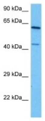 Western Blot: Cytochrome P450 4A Antibody [NBP3-10812] - Western blot analysis of Cytochrome P450 4A in Human 293T Whole Cell lysates. Antibody dilution at 1ug/ml