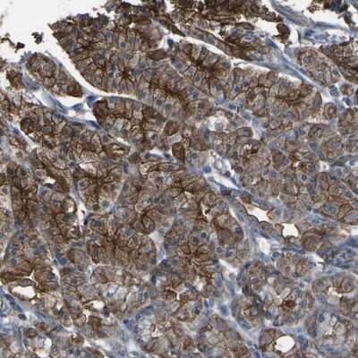 Immunohistochemistry-Paraffin: Cytochrome P450 4F11 Antibody [NBP1-87461] - Staining of human stomach shows strong cytoplasmic and membranous positivity in glandular cells.