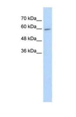 Western Blot: Cytochrome P450 4F11 Antibody [NBP1-69423] - This Anti-CYP4F11 antibody was used in Western Blot of HepG2 tissue lysate at a concentration of 5ug/ml.