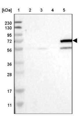 Western Blot: Cytochrome P450 4F11 Antibody [NBP1-87461] - Lane 1: Marker  [kDa] 230, 130, 95, 72, 56, 36, 28, 17, 11.  Lane 2: Human cell line RT-4.  Lane 3: Human cell line U-251MG sp.  Lane 4: Human plasma (IgG/HSA depleted).  Lane 5: Human liver tissue