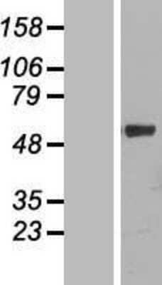 Western Blot: Cytochrome P450 4F11 Overexpression Lysate (Adult Normal) [NBL1-09697] Left-Empty vector transfected control cell lysate (HEK293 cell lysate); Right -Over-expression Lysate for Cytochrome P450 4F11.