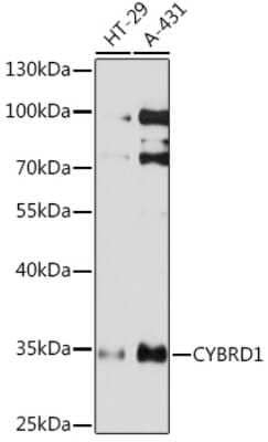 Western Blot: Cytochrome b reductase 1 Antibody [NBP3-15534] - Western blot analysis of extracts of various cell lines, using Cytochrome b reductase 1 Rabbit pAb (NBP3-15534) at 1:1000 dilution. Secondary antibody: HRP Goat Anti-Rabbit IgG (H+L) at 1:10000 dilution. Lysates/proteins: 25ug per lane. Blocking buffer: 3% nonfat dry milk in TBST. Detection: ECL Basic Kit. Exposure time: 10s.