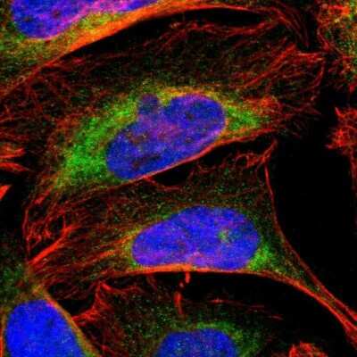 Immunocytochemistry/ Immunofluorescence Cytochrome b5 Outer Mitochondrial Membrane Antibody - BSA Free