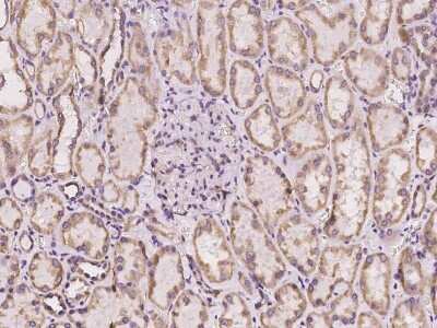 Immunohistochemistry: Cytochrome b5 Outer Mitochondrial Membrane Antibody [NBP2-97403] - Immunochemical staining of human Cytochrome b5 Outer Mitochondrial in human kidney with rabbit polyclonal antibody at 1:100 dilution, formalin-fixed paraffin embedded sections.