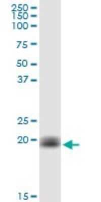 Western Blot: Cytochrome b5 Outer Mitochondrial Membrane Antibody [H00080777-B01P] - Analysis of CYB5B expression in Jurkat.