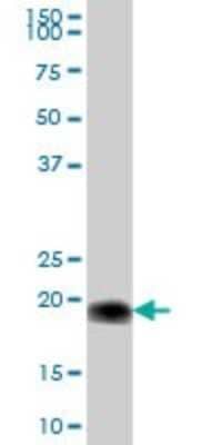 Western Blot Cytochrome b5 Outer Mitochondrial Membrane Antibody - Azide and BSA Free