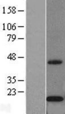 Western Blot: Cytochrome b5 Outer Mitochondrial Membrane Overexpression Lysate (Adult Normal) [NBL1-09652] Left-Empty vector transfected control cell lysate (HEK293 cell lysate); Right -Over-expression Lysate for Cytochrome b5 Outer Mitochondrial Membrane.
