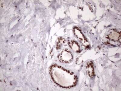 Immunohistochemistry: LIPT2-AS1 Antibody (OTI4C7) [NBP2-45841] - Analysis of Human breast tissue. (Heat-induced epitope retrieval by 1mM EDTA in 10mM Tris buffer (pH8.5) at 120C for 3 min)