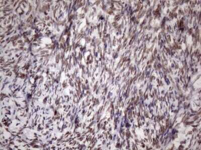 Immunohistochemistry: LIPT2-AS1 Antibody (OTI4C7) [NBP2-45841] - Analysis of Human Ovary tissue. (Heat-induced epitope retrieval by 1mM EDTA in 10mM Tris buffer (pH8.5) at 120C for 3 min)