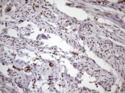 Immunohistochemistry: LIPT2-AS1 Antibody (OTI4C7) [NBP2-45841] - nalysis of Human endometrium tissue. (Heat-induced epitope retrieval by 1mM EDTA in 10mM Tris buffer (pH8.5) at 120C for 3 min)