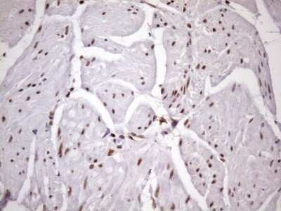 Immunohistochemistry: LIPT2-AS1 Antibody (OTI4C7) [NBP2-45841] - Analysis of Human bladder tissue. (Heat-induced epitope retrieval by 1mM EDTA in 10mM Tris buffer (pH8.5) at 120C for 3 min)