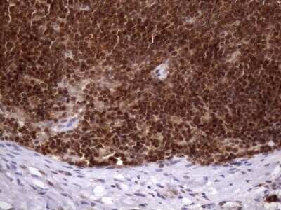 Immunohistochemistry: LIPT2-AS1 Antibody (OTI4C7) [NBP2-45841] - Analysis of Human lymph node tissue. (Heat-induced epitope retrieval by 1mM EDTA in 10mM Tris buffer (pH8.5) at 120 C for 3 min)