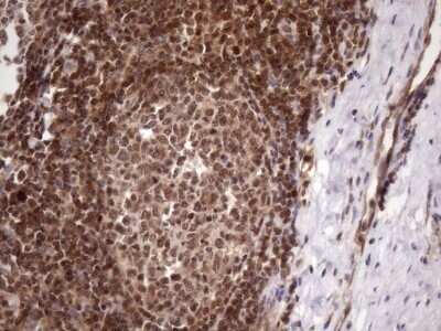 Immunohistochemistry: LIPT2-AS1 Antibody (OTI4C7) [NBP2-45841] - Analysis of Human tonsil within the normal limits using LIPT2-AS1 mouse monoclonal antibody.(Heat-induced epitope retrieval by 1mM EDTA in 10mM Tris buffer (pH8.5) at 120C for 3 min)(1:150)