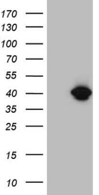 Western Blot: LIPT2-AS1 Antibody (OTI4C7) [NBP2-45841] - Analysis of HEK293T cells were transfected with the pCMV6-ENTRY control (Left lane) or pCMV6-ENTRY LIPT2-AS1.