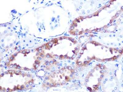 Immunohistochemistry-Paraffin: Cytochrome c Antibody (6R10F3) [NBP3-16512] - Immunohistochemistry of paraffin-embedded rat kidney using Cytochrome c Rabbit mAb (NBP3-16512) at dilution of 1:100 (40x lens).Perform microwave antigen retrieval with 10 mM PBS buffer pH 7.2 before commencing with IHC staining protocol.