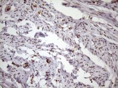 Immunohistochemistry: LIPT2-AS1 Antibody (OTI4C7) - Azide and BSA Free [NBP2-71949] - Analysis of Human endometrium tissue. (Heat-induced epitope retrieval by 1mM EDTA in 10mM Tris buffer (pH8.5) at 120C for 3 min)