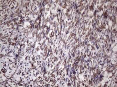 Immunohistochemistry: LIPT2-AS1 Antibody (OTI4C7) - Azide and BSA Free [NBP2-71949] - Analysis of Human Ovary tissue. (Heat-induced epitope retrieval by 1mM EDTA in 10mM Tris buffer (pH8.5) at 120C for 3 min)