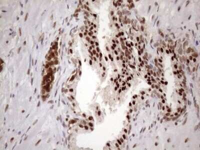 Immunohistochemistry: LIPT2-AS1 Antibody (OTI4C7) - Azide and BSA Free [NBP2-71949] - Analysis of Human prostate tissue. (Heat-induced epitope retrieval by 1mM EDTA in 10mM Tris buffer (pH8.5) at 120C for 3 min)