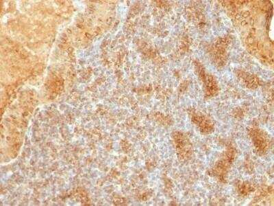 Immunohistochemistry-Paraffin: Cytochrome c Antibody (SPM389) - Azide and BSA Free [NBP2-47692] - Human Salivary Tumor stained with Cytochrome C Monoclonal Antibody (SPM389).