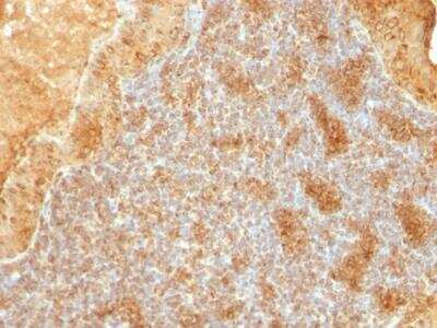 Immunohistochemistry-Paraffin: Cytochrome c Antibody (SPM389) - IHC-Prediluted [NBP2-48147] - Formalin-fixed, paraffin-embedded human Salivary Tumor stained with Cytochrome C Monoclonal Antibody (SPM389).