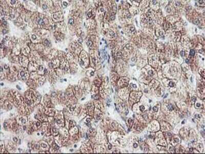 Immunohistochemistry: Cytochrome p450 2J2 Antibody (OTI5C5) - Azide and BSA Free [NBP2-70539] - Staining of paraffin-embedded Human liver tissue using anti-Cytochrome p450 2J2 mouse monoclonal antibody.