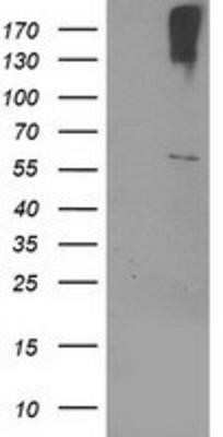 Western Blot: Cytochrome p450 2J2 Antibody (OTI5C5) - Azide and BSA Free [NBP2-70539] - HEK293T cells were transfected with the pCMV6-ENTRY control (Left lane) or pCMV6-ENTRY Cytochrome p450 2J2 (Right lane) cDNA for 48 hrs and lysed. Equivalent amounts of cell lysates (5 ug per lane) were separated by SDS-PAGE and immunoblotted with anti-Cy