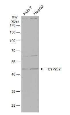 Western Blot: Cytochrome p450 2J2 Antibody [NBP2-16079] - Various whole cell extracts (30 ug) were separated by 10% SDS-PAGE, and the membrane was blotted with CYP2J2 antibody [N3C3] diluted at 1:500. The HRP-conjugated anti-rabbit IgG antibody (NBP2-19301) was used to detect the primary antibody.