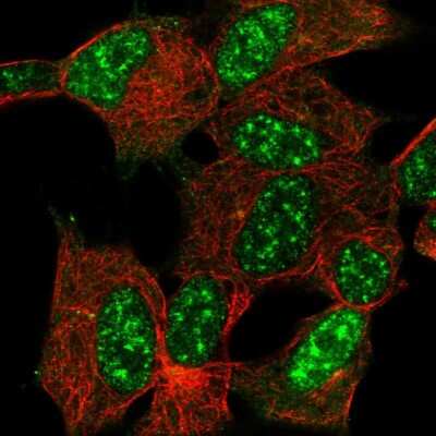 Immunocytochemistry/Immunofluorescence: Cytoglobin Antibody [NBP2-55897] - Staining of human cell line SH-SY5Y shows localization to nuclear speckles.