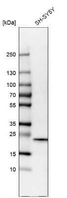 Western Blot: Cytoglobin Antibody [NBP1-89701] - Analysis in human cell line SH-SY5Y.