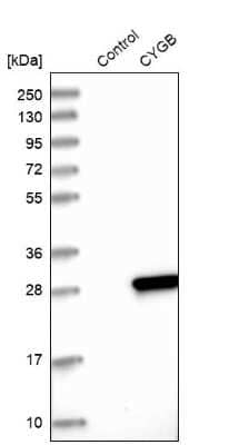 Western Blot: Cytoglobin Antibody [NBP1-89701] - Analysis in control (vector only transfected HEK293T lysate) and CYGB over-expression lysate (Co-expressed with a C-terminal myc-DDK tag (3.1 kDa) in mammalian HEK293T cells).