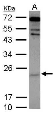 Western Blot: Cytoglobin Antibody [NBP2-16084] - Sample (30 ug of whole cell lysate) A: IMR32 12% SDS PAGE gel, diluted at 1:2000.