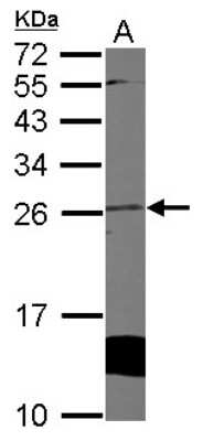 Western Blot: Cytoglobin Antibody [NBP2-16084] - Sample (50 ug of whole cell lysate) A: Mouse Heart, 12% SDS PAGE gel, diluted at 1:1000.