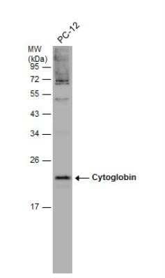 Western Blot Cytoglobin Antibody