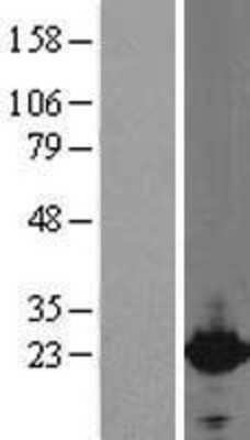 Western Blot Cytoglobin Overexpression Lysate