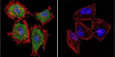 Immunocytochemistry/Immunofluorescence: Cytohesin-1 Antibody (2E+11) [NBP2-22512] - Analysis of Cytohesin 1 in HeLa Cells. Cells were grown on chamber slides and fixed with formaldehyde prior to staining. Cells were probed without (control) or with a Cytohesin 1 monoclonal antibody at a dilution of 1:20 overnight at 4C, washed with PBS and incubated with a DyLight-488 conjugated secondary antibody. Cytohesin 1 staining (green), F-Actin staining with Phalloidin (red) and nuclei with DAPI (blue) is shown.