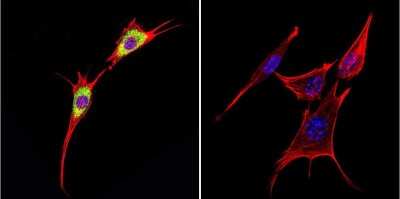 Immunocytochemistry/Immunofluorescence: Cytohesin-1 Antibody (2E+11) [NBP2-22512] - Analysis of Cytohesin 1 in NIH-3T3 Cells. Cells were grown on chamber slides and fixed with formaldehyde prior to staining. Cells were probed without (control) or with a Cytohesin 1 monoclonal antibody at a dilution of 1:20 overnight at 4C, washed with PBS and incubated with a DyLight-488 conjugated secondary antibody. Cytohesin 1 staining (green), F-Actin staining with Phalloidin (red) and nuclei with DAPI (blue) is shown.
