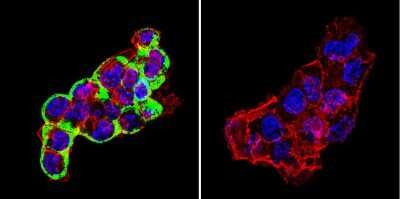 Immunocytochemistry/Immunofluorescence: Cytohesin 2 Antibody (10A12) [NBP2-22514] - Analysis of Cytohesin 2 in HepG2 Cells. Cells were grown on chamber slides and fixed with formaldehyde prior to staining. Cells were probed without (control) or with a Cytohesin 2 monoclonal antibody at a dilution of 1:100 overnight at 4C, washed with PBS and incubated with a DyLight-488 conjugated secondary antibody. Cytohesin 2 staining (green), F-Actin staining with Phalloidin (red) and nuclei with DAPI (blue) is shown.