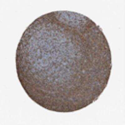 Immunohistochemistry: Cytohesin 2 Antibody [20590002] - Most of the normal tissues displayed weak to moderate cytoplasmic positivity. Distinct cytoplasmic staining was seen in a fraction of cells in red pulp of spleen and distinct membranous positivity was seen in trophoblasts. Squamous epithelia, urothelia, kidney, myocytes and cells of the CNS were mainly negative. Malignant tissues were negative or showed weak cytoplasmic immunoreactivity. A single case of lymphoma exhibited strong staining. Melanomas and urothelial cancers were predominantly weakly to moderately stained.  Image and statement courtesy of the Human Protein Atlas (HPA).