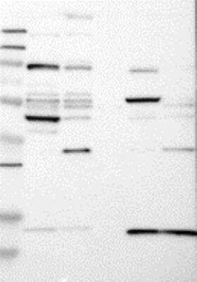 Western Blot: Cytohesin 2 Antibody [20590002] - Samples:  Lane 1, Marker [kDa]: 250, 130, 95, 72, 55, 36, 28, 17, 11  Lane 2, RT-4  Lane 3, U-251MG sp  Lane 4, Human Plasma Lane 5, Liver  Lane 6, Tonsil ,   Target weight [kDa]:   47, 46 (splice variants)   Validation score:   2   Validation description: Supportive - Band of predicted size in kDa (+/-20%) with additional bands present.