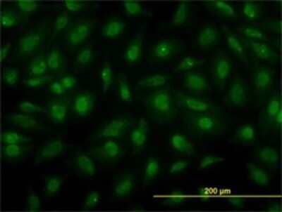 Immunocytochemistry/ Immunofluorescence Cytohesin 3 Antibody (6D3-1A9)