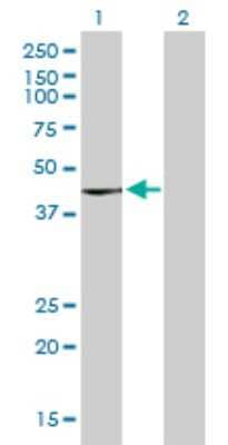 Western Blot Cytohesin 3 Antibody (6D3-1A9)