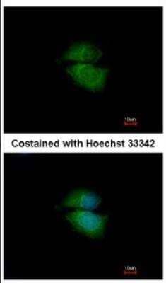 Immunocytochemistry/Immunofluorescence: Cytohesin 3 Antibody [NBP2-16085] - Immunofluorescence analysis of methanol-fixed MCF-7, using antibody at 1:200 dilution.